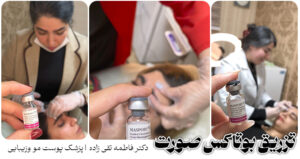 بوتاکس اندیشه